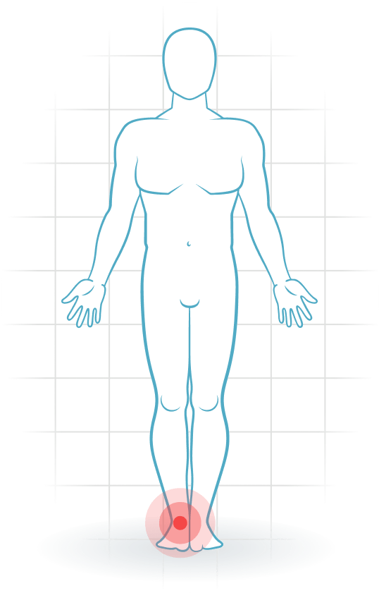 pijnlocatie Anterior ankle impingement